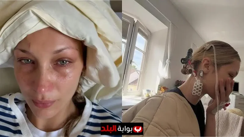 Bella Hadid Opens Up About Her Chronic Lyme Disease Battle: Exclusive Look at Hospital Struggles, Family Support, and Her Journey to Recovery