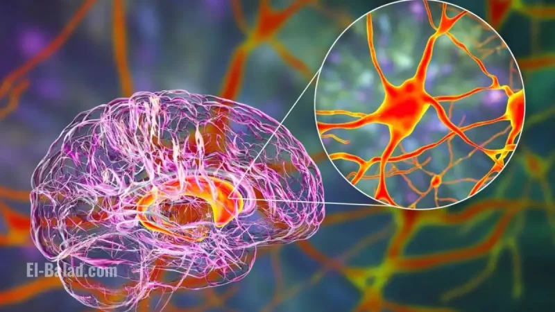Landmark Breakthrough: Gene Therapy Slows Huntington's Disease Progression, Raising Hope for Millions