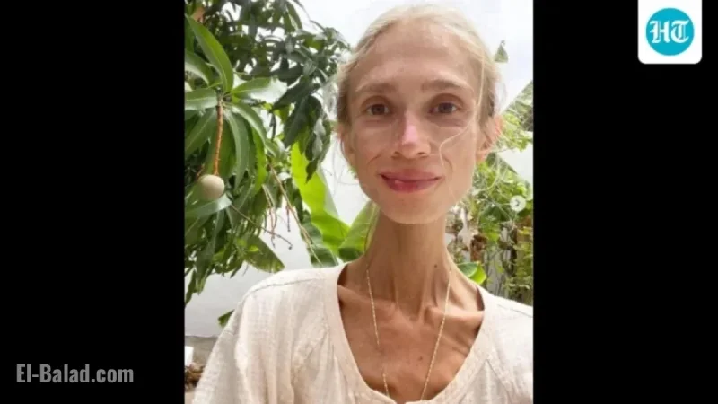 27-Year-Old Woman Dies in Bali After Adopting Fruitarian Diet