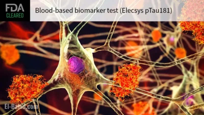 Blood Test Confirms Absence of Alzheimer’s Disease