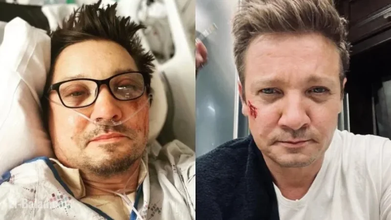 Jeremy Renner accident: latest on recovery, resilience, and what’s next