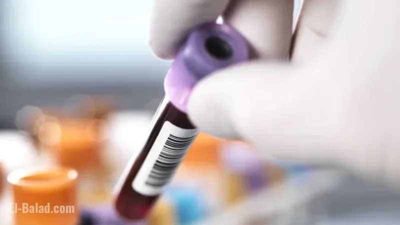 CRISPR Gene-Editing Reduces High Cholesterol, New Study Finds