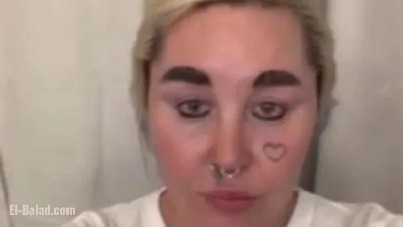Amanda Bynes Uses Weight-Loss Drug for Slimmer, Attractive Look