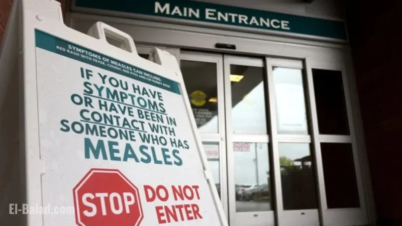 Canada Loses Measles Elimination Status After 25 Years