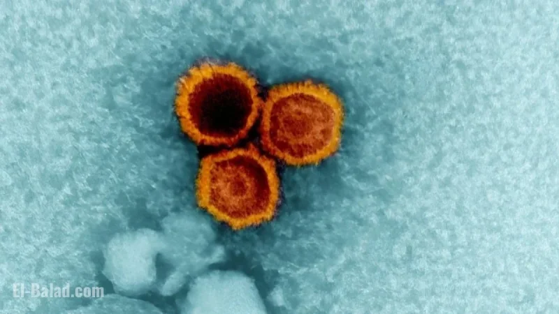 Study Links Common Epstein-Barr Virus to Lupus Development
