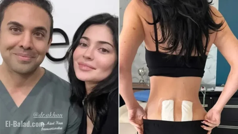 Kylie Jenner Undergoes Stem Cell Therapy for Chronic Post-Pregnancy Back Pain Relief