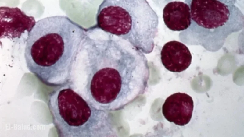 Gilead and Arcellx Report Strong Results for Multiple Myeloma Drug Anito-cel