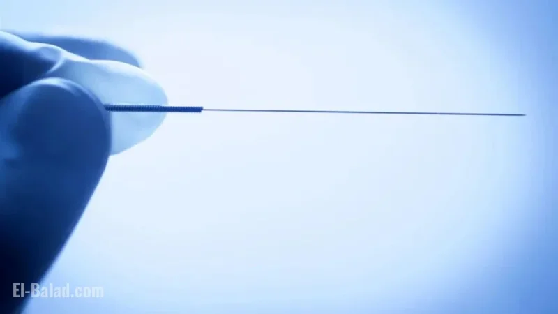 Understanding Dry Needling: Risks Highlighted After T.J. Watt’s Lung Collapse