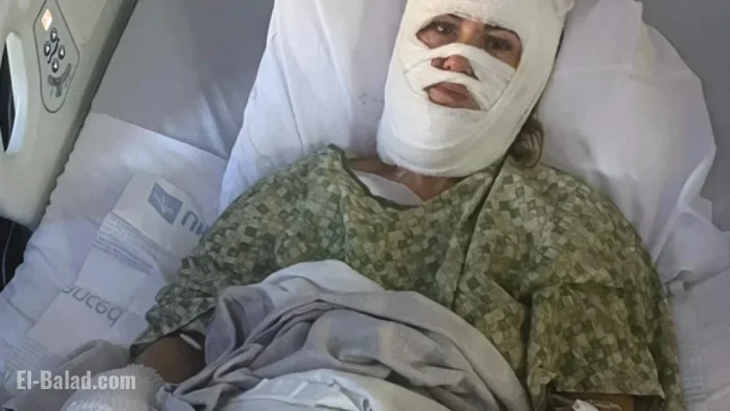 Woman Severely Burned in Georgia Park Chemical Attack