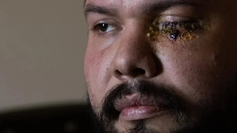Homeland Security Accused of Blinding Man at Anti-ICE Rally