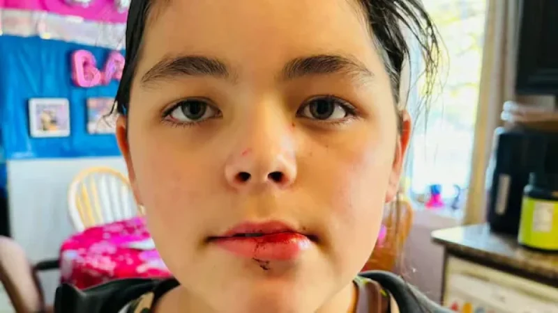 First Nations Student Attacked in Alleged Racist Incident at Steinbach School