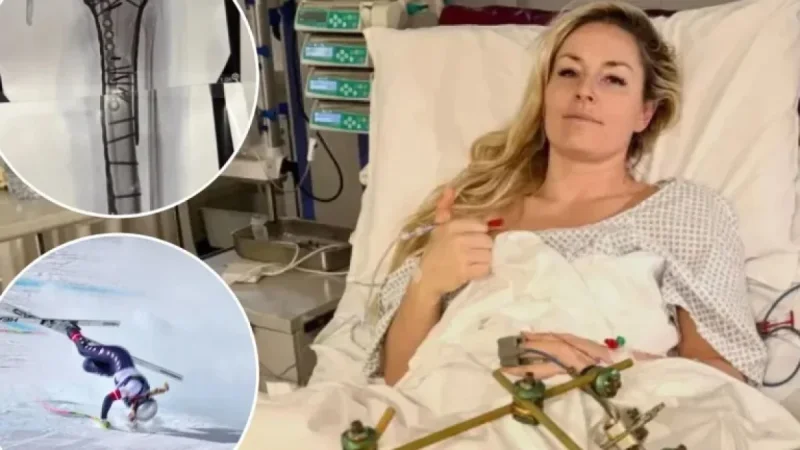 Lindsey Vonn Shares Gruesome Update Post-Olympic Crash: “Truly Bionic Now”