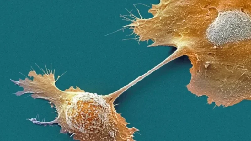 FDA Authorizes Novocure’s New Device to Prolong Pancreatic Cancer Survival