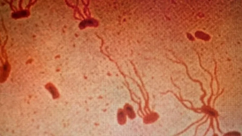 Scientists Warn: Ancient Pathogen Quickly Developing Antibiotic Resistance