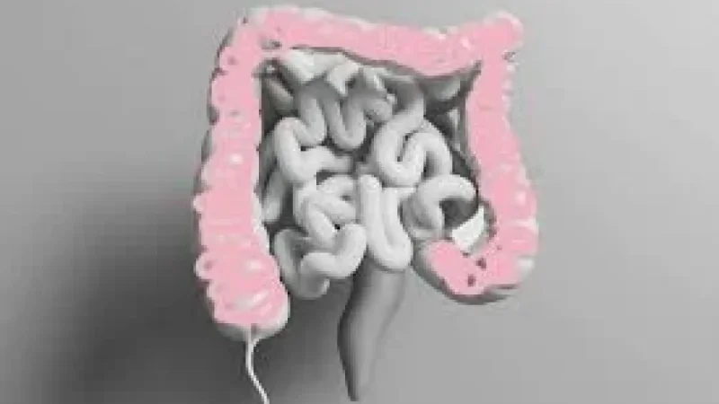 Colon Cancer Symptoms: Now Leading Cause of Cancer Deaths Under 50 in US