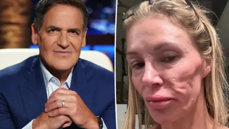 Mark Cuban Pharmacy Helped Brandi Glanville Cut Medication Costs Amid Facial Disfigurement Fight
