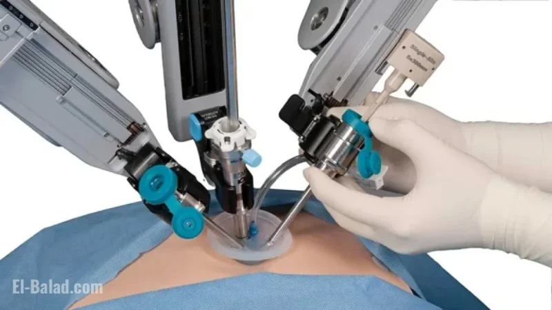 Robotic Surgery Leader Soars 12% on Exceeding Forecasts