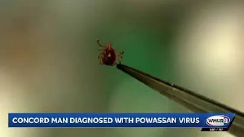 Powassan Virus Can Spread in 15 Minutes After Tick Attachment