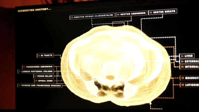 Midjourney Unveils Full-Body Scanner With 60-Second Ultrasound