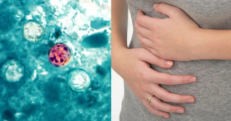 Illinois Reports 11 to 30 Cyclospora Cases Since May