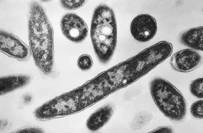 New York City health officials report 14 Legionnaires' Disease cases