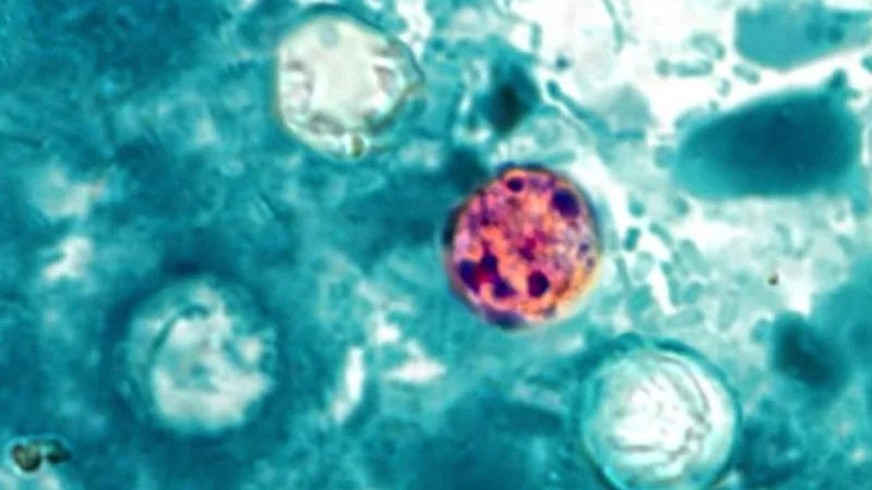 Cyclosporiasis cases surge in Michigan as Ohio reports 177 infections
