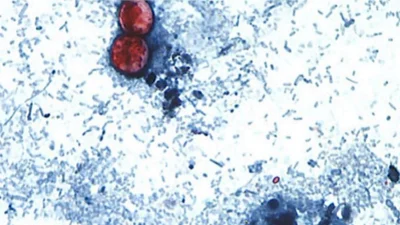 Taco Bell trims ingredients at select restaurants during cyclosporiasis outbreak — Taco Bell Food