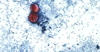 Taylor Farms Recall expands lettuce pulled from 27 states over cyclospora risk