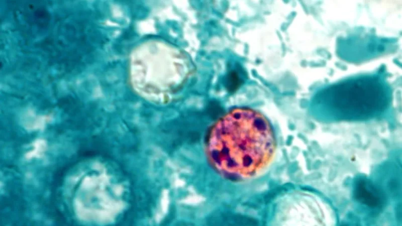 CDC Says Cyclosporiasis Outbreak Spans Nine States — Massive Cyclosporiasis Outbreak Linked To Four More States