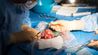 Nitipong Permpalung Reports Remdesivir Linked to 47% Lower Risk