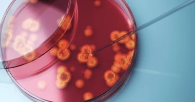 CDC Reports More Than 3,000 Deadly Fungus Outbreak Cases in 23 States