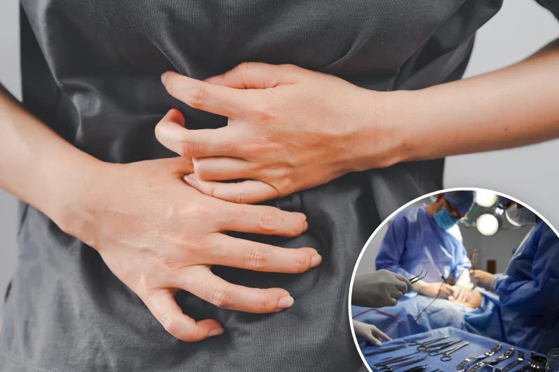 Dr Rahman struck off after wrong bowel surgery connection