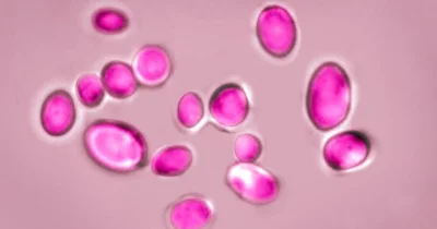 Texas leads Candida Auris cases with 1,148 reported