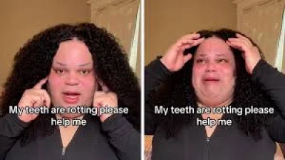 Jools Lebron Deletes GoFundMe for New Teeth, May Leave TikTok
