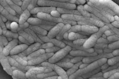 UK Health Security Agency Links 207 Cases to Imported Eggs Linked To Salmonella