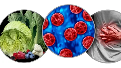 CDC Adds New Mexico to Confirmed Cyclosporiasis Cases In All 48 States