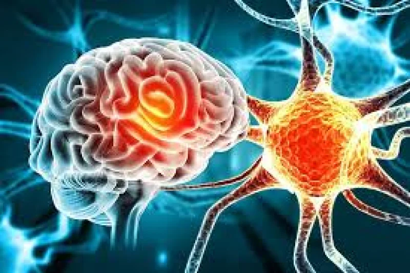 Surrey trust joins first European Trontinemab Alzheimer's trial