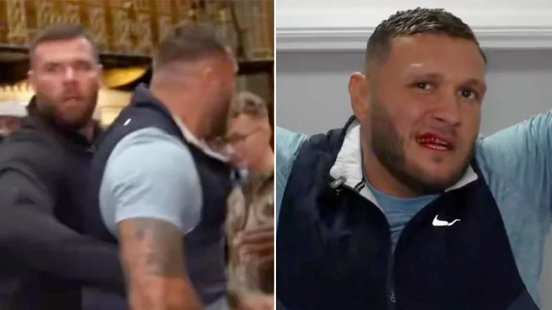 Big Stacks left bleeding days before Jordan McCann fight — Misfits Boxing