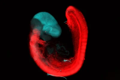 Kyle Loh finds Two Separate Brain Systems Research in 2 lineages