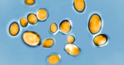CDC Reports 50,800 Drug Resistance Deaths in the United States