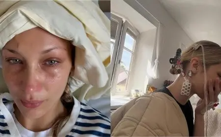 Bella Hadid Opens Up About Her Chronic Lyme Disease Battle: Exclusive Look at Hospital Struggles, Family Support, and Her Journey to Recovery
