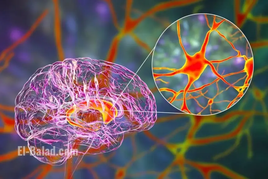 Landmark Breakthrough: Gene Therapy Slows Huntington's Disease Progression, Raising Hope for Millions