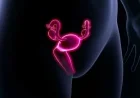 Understanding Proximal-Type Epithelioid Sarcoma of the Vulva Complexities