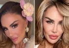 Ninel Conde Unveils New Eye Color After Surgery: See Her New Look