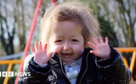 DIY SOS Transforms Home for Child with Rare Illness