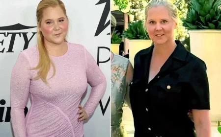 Amy Schumer Flaunts Remarkable Weight Loss in New Photo: ‘Legs for Days’
