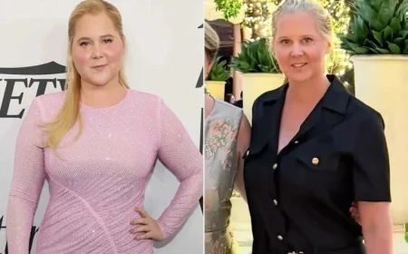 “Loving Support: Grateful Legs Celebrate Care”