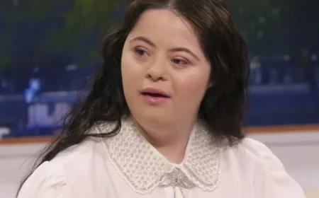 Ellie Goldstein’s Mom Shares Strictly Star’s Overcoming Challenges