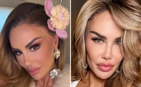 Ninel Conde Unveils New Eye Color After Surgery: See Her New Look