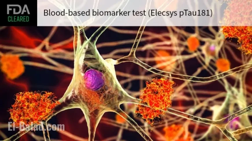 Blood Test Confirms Absence of Alzheimer’s Disease